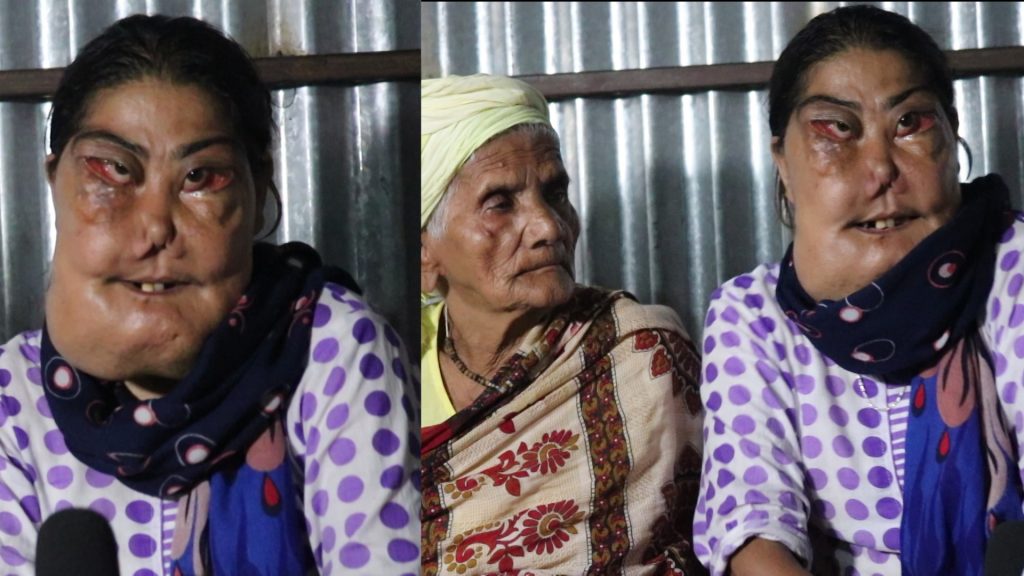 मेरी छोरीलाई देखेर सब डराउछन हास्छन,८२ बर्षे आमा र छोरिको अन्तर्वातामै रुवाबासी(भिडियो सहित )