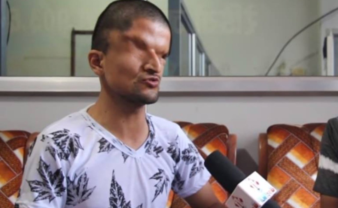 काठमाडौं पुगेर यस्तो भने रमेश प्रसाईले