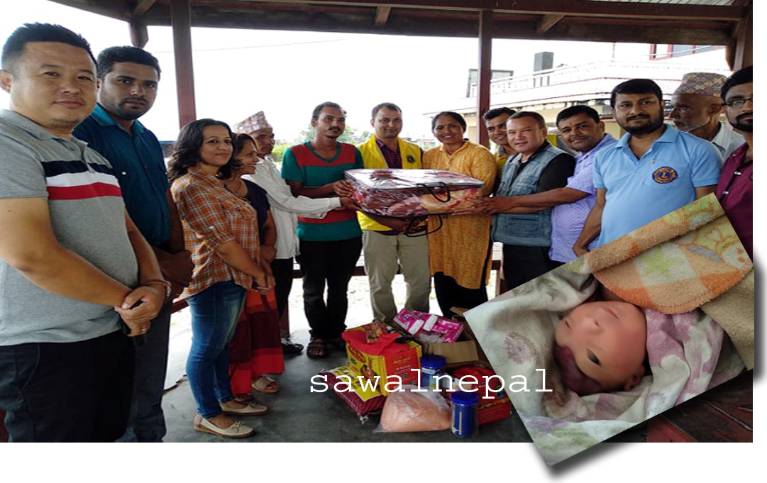 आम्दा अस्पतालमा तालु नभएको बच्चाको जन्म, सुत्केरीका लागि लायन्स क्लवहरुको सहयोग