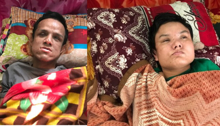 २० वर्ष भयो सुतेको, न पल्टिन सक्छन् न उठन् !